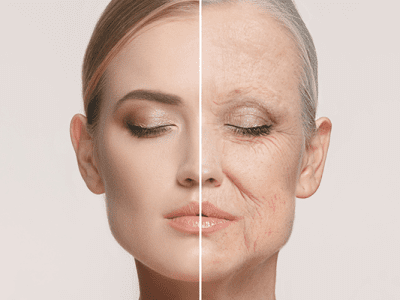 Kırışıklık Tedavisi