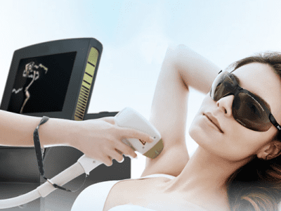 Kadın Lazer Epilasyon