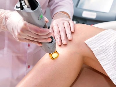 Lazer Epilasyonun Faydaları Nedir ? – Üsküdar Lazer Epilasyon