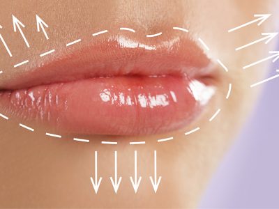 Dudak Dolgusu Nişantaşı Hakkında Bilmeniz Gereken Herşey!