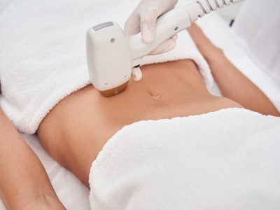 Lazer Epilasyon Nişantaşı: Seans Aralıkları ve Bilmeniz Gerekenler