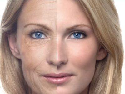 Kırışıklık Tedavisi: Genç ve Pürüzsüz Bir Cilt İçin En Etkili Yöntemler